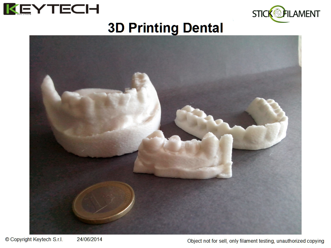  3D Printing Dental